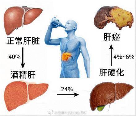 如何预防酒精肝？ 保证充足的睡眠 促进肝细胞功能的恢复(图1)