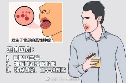 舌癌要如何预防？ (图1)