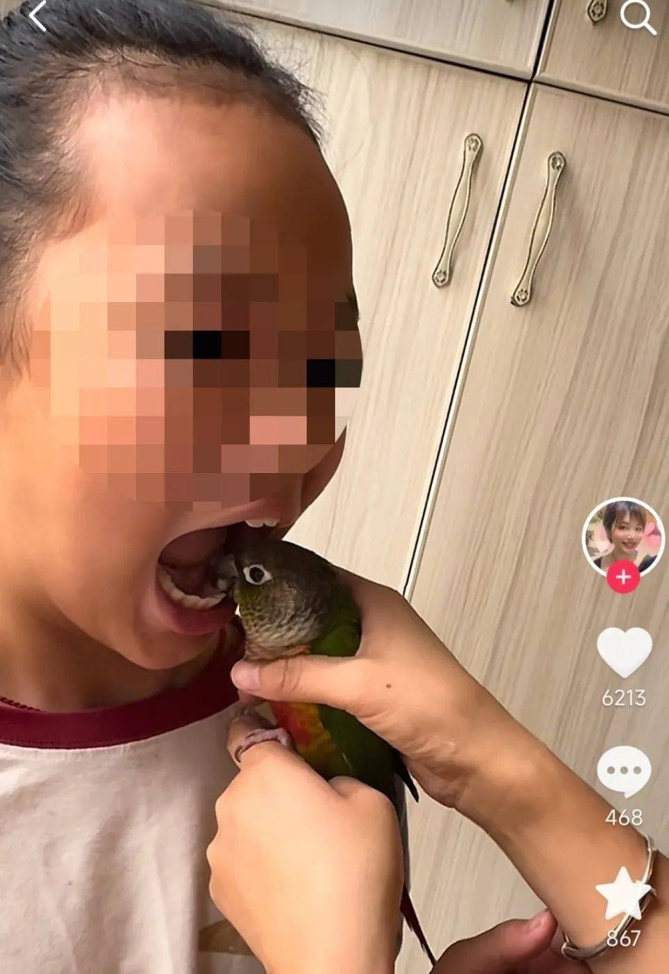 女子用鹦鹉为孩子拔牙，医生：或致感染鹦鹉热、禽流感 (pic1)