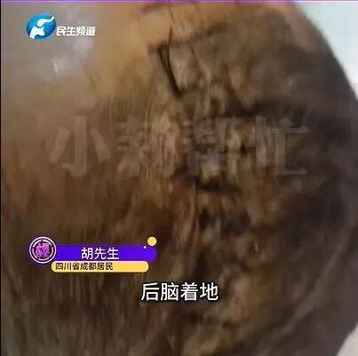 女子睡前没摘发饰，夜里插入耳朵直抵后脑勺！医生：绝非个例！ (pic2)