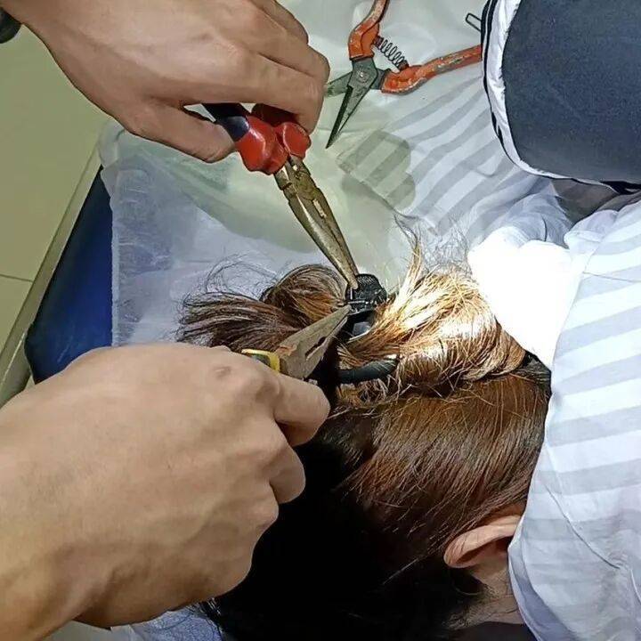 女子睡前没摘发饰，夜里插入耳朵直抵后脑勺！医生：绝非个例！ (pic3)