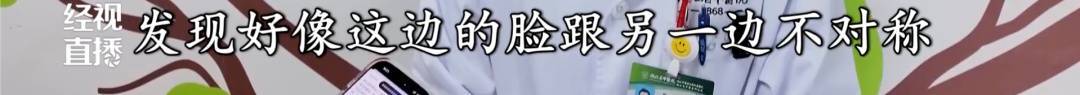 武汉女子一觉醒来脸“歪”了！医生：冬季高发，发病时都有这个表现……紧急提醒 (pic3)