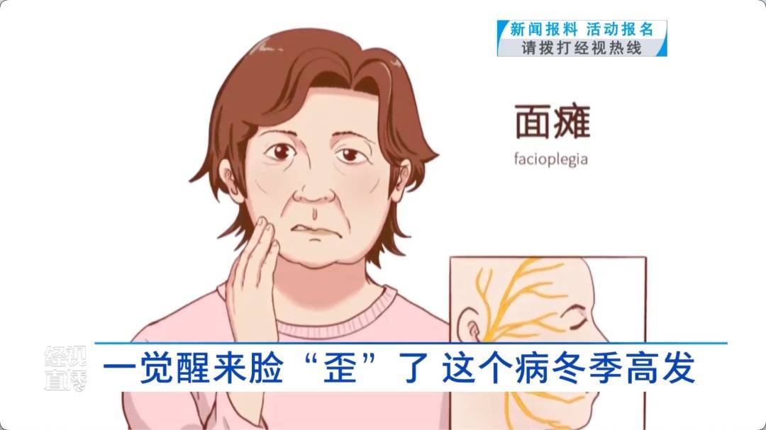 武汉女子一觉醒来脸“歪”了！医生：冬季高发，发病时都有这个表现……紧急提醒 (pic4)