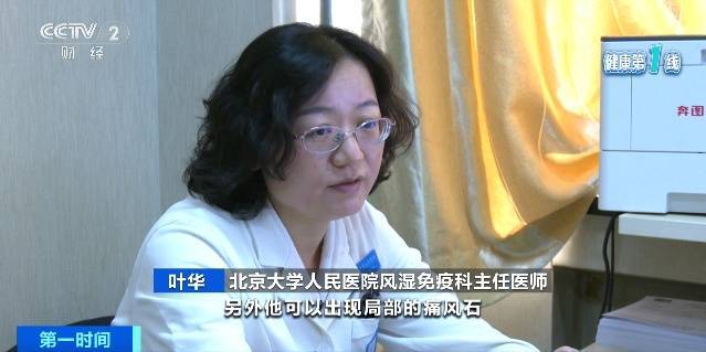超1亿人患病!以为关节炎只是老年病?这些因素正让它悄悄盯上年轻人 (pic7) 超1亿人患病!以为关节炎只是老年病?这些因素正让它悄悄盯上年轻人 (pic7)