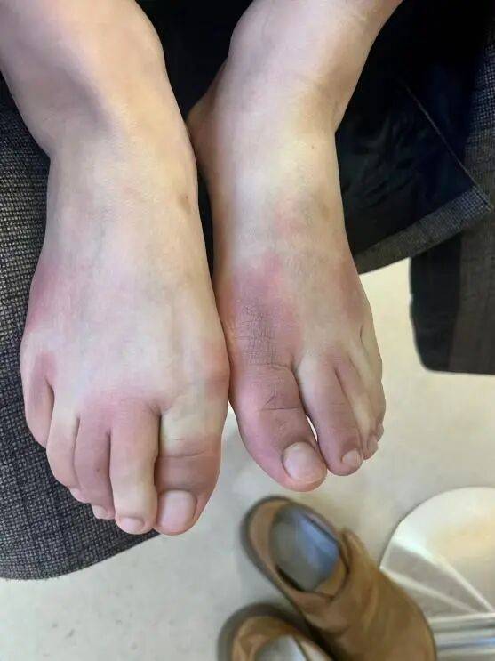 破防了！北方人遭南方过冬暴击，穿满“装备”仍扛不住湿冷，网友：懂这种痛 (pic3)