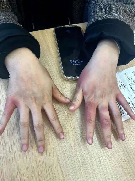 破防了！北方人遭南方过冬暴击，穿满“装备”仍扛不住湿冷，网友：懂这种痛 (pic2)