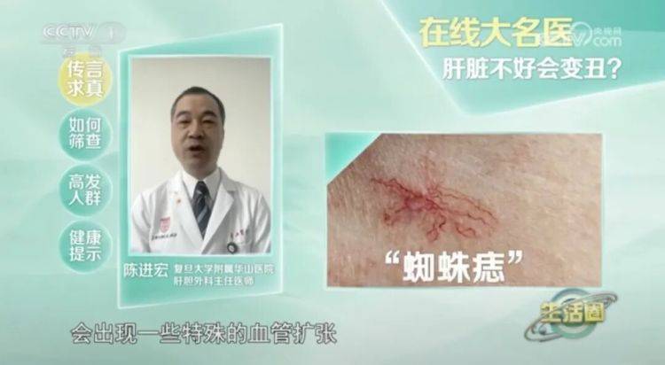 出现这种面相,可能是肿瘤前兆!别以为只是“发福”了 (pic2) 出现这种面相,可能是肿瘤前兆!别以为只是“发福”了 (pic2)