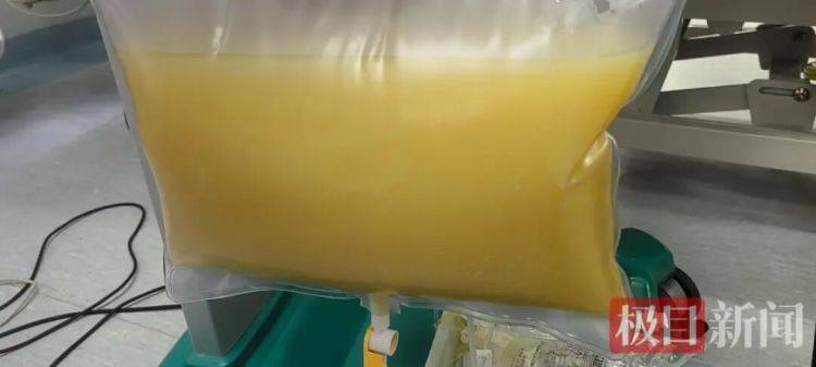 大学生凌晨3点突发剧烈腹痛，血液变成“牛奶血”，只因寒假吃喝无节制 (pic2)