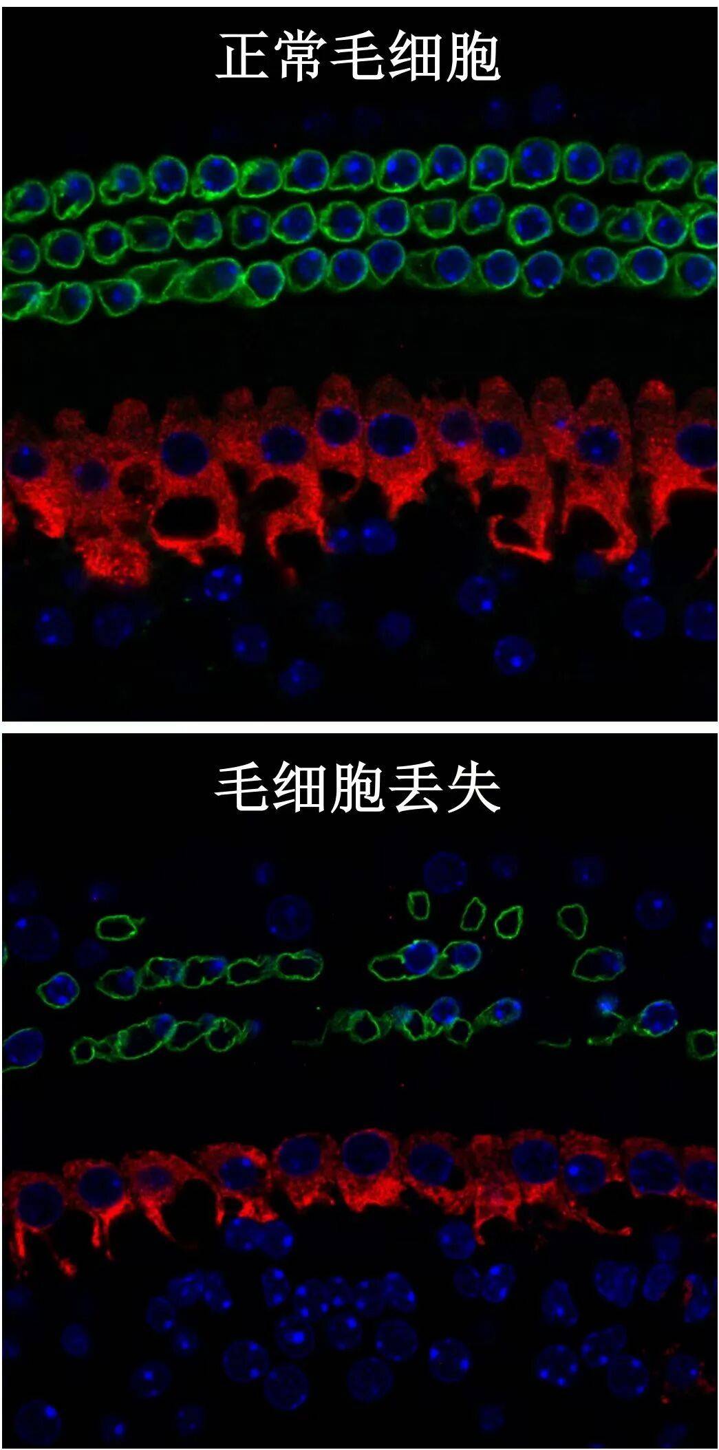 大学生戴耳机入睡，耳机在耳朵里爆炸：非“杂牌”，此前未出现异常 (pic5)