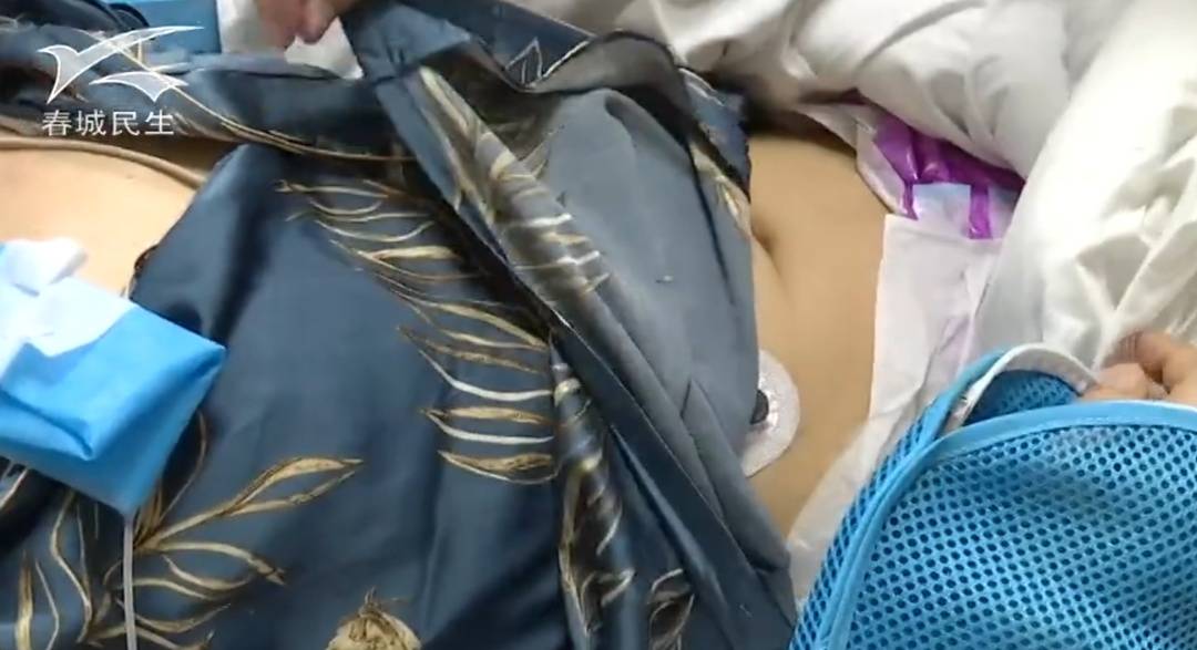 云南一男子吃菌中毒后幻想在“修仙”,突然翻出27楼窗户往下爬,被救后直呼:戒了戒了 (pic4) 云南一男子吃菌中毒后幻想在“修仙”,突然翻出27楼窗户往下爬,被救后直呼:戒了戒了 (pic4)
