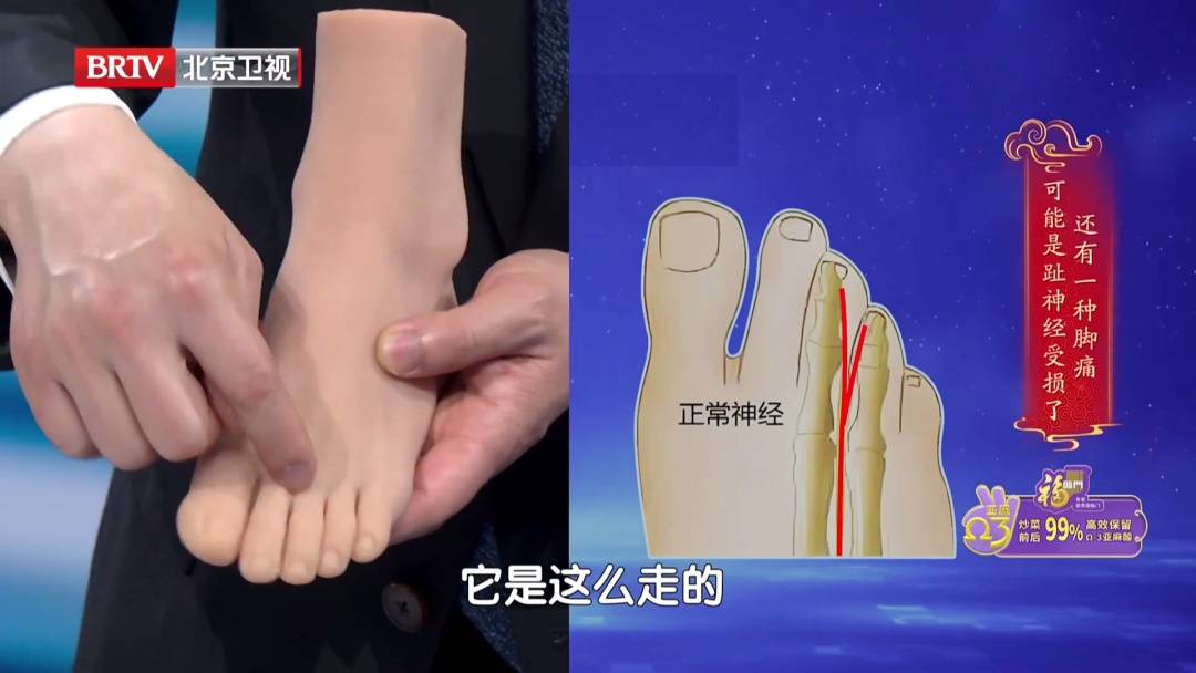 走路多了脚疼不正常？医生：这种疼可能是神经在报警，两个小妙招，轻松护足 (pic14)